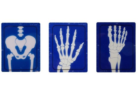 LEAN Toys Zestaw Lekarski Aparatura Akcesoria Medyczne RTG Doktor LEAN Toys Zestaw Lekarski Aparatura Akcesoria Medyczne RTG Doktor